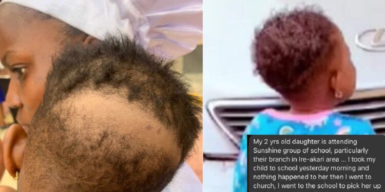 Mom raises alarm after her two-year-old daughter’s hair was allegedly scraped in Ibadan