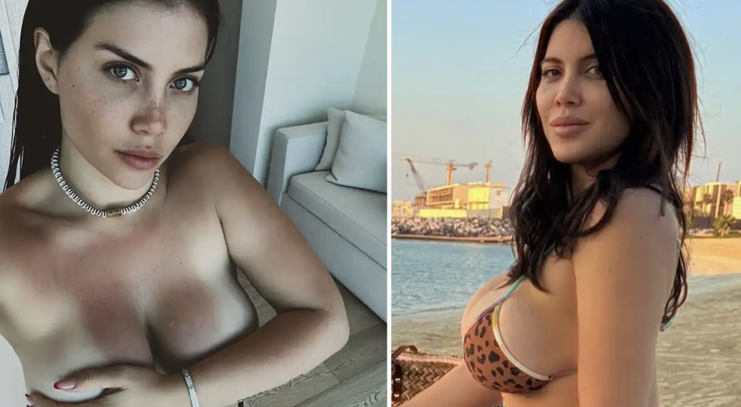 Famous footballer’s wife risks social media ban, after showing off sunburned bo*bs in topless snap