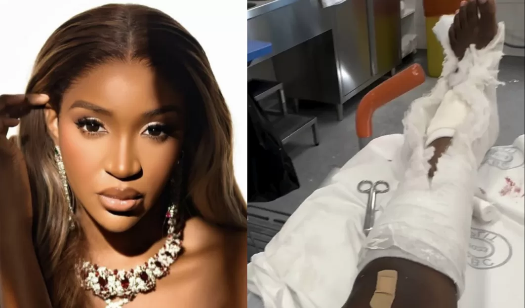 Famous Nollywood Actress Left Unable To Walk After Suffering Accident While On Vacation To Celebrate Her Birthday