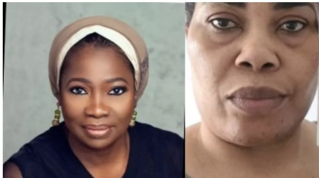 Abike Dabiri-Erewa releases photo of Nigerian woman in viral audio clip threatening to poison and kill other Nigerians residing in Canada