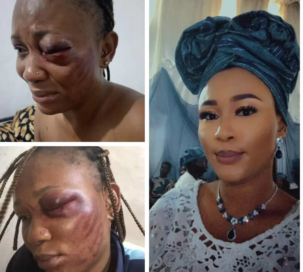 Nigerian woman cries out for help after 15 years of abusive marriage